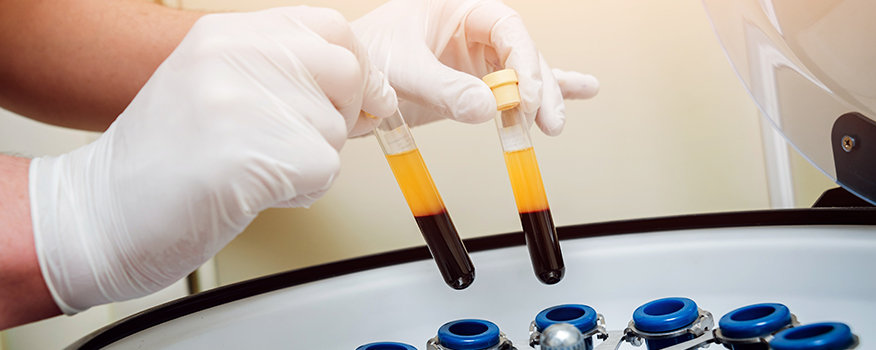 Pro Injection PRP Injections in Cardiff: Expert Treatment for Joint & Tendon Pain